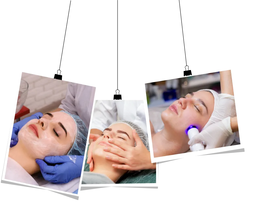 laser facials